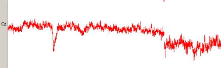 Figure 2.8 : enregistrement EEG brut