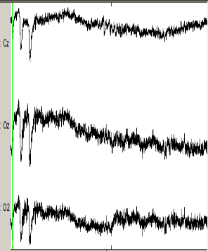 Figure 3.11 : données EEG après sélection des canaux