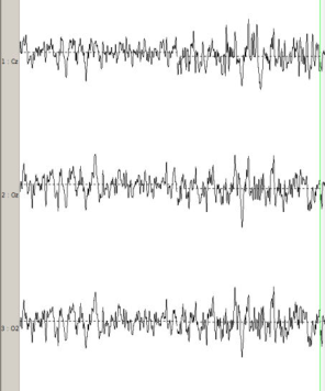 Figure 3.12 : données EEG après filtrage et reconstruction