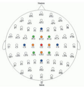 Figure A.1 : trois filtres laplaciens appliqués à l'électrode Cz